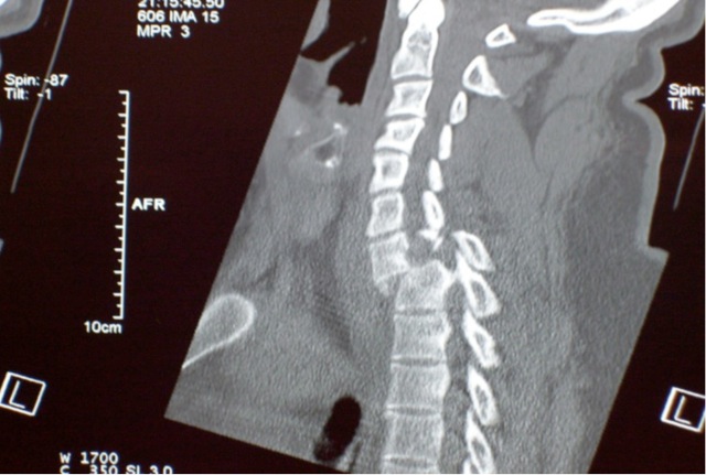 Loading Image