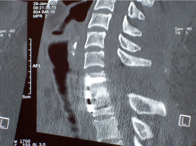 Loading Image
